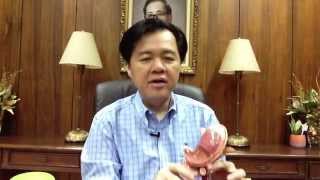 Stomach Ulcer and Hyperacidity Dr Willie Ong Health Blog 24 [upl. by Annais]