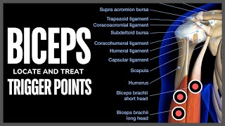 Understanding Trigger Points in the Biceps Muscle [upl. by Yanarp62]