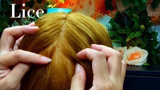 ASMR Lice Removal Pop the Lice directly on the Scalp and nails 😴💤🥱 [upl. by Emile]