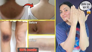 Dark Neck Elbow Knee Back Full Body Tan कालेपन को जड़ से खत्म करें सिर्फ 1 बार में ❤️ [upl. by Priebe]