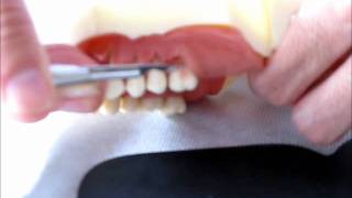 Cirurgia plástica periodontal em modelo Dentart [upl. by Ahtanoj]