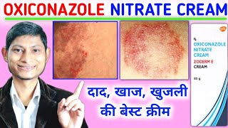 Oxiconazole nitrate cream  oxiconazole nitrate cream zoderm e cream uses in hindi  zoderm e cream [upl. by Syxela]