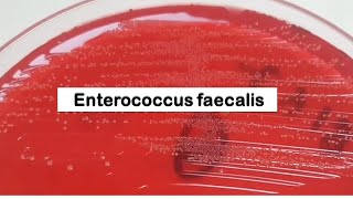 Enterococcus faecalis Colony Morphology on CLED Agar [upl. by Aramoy]