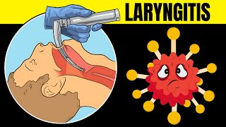 Laryngitis Acute amp Chronic  Causes Signs amp Symptoms Diagnosis And Treatment [upl. by Atenik]