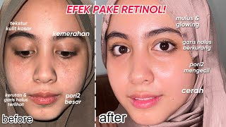 FIX INI SERUM RETINOL TERBAIK HASILNYA BAGUS BGT WOYY  Kiehl’s retinol serum review [upl. by Eniawd]