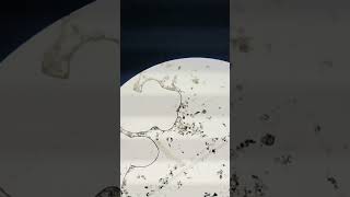 Zooplankton found in pond water biology microscopevideo [upl. by Adnylam]