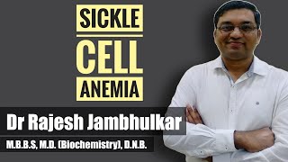 Sickle cell anemia [upl. by Kotz]