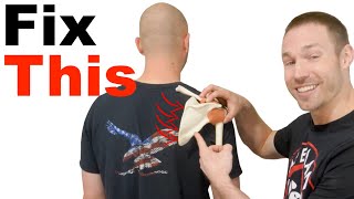 How to Fix Scapular Winging [upl. by Frankhouse5]