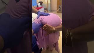 Chiropractor Treatment For Heavy Tailbone Pain mumbai delhi [upl. by Kamilah]