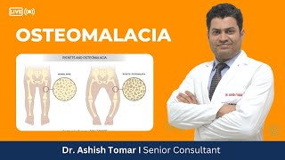 Everything about Osteomalacia I Dr Ashish Tomar [upl. by Ociral452]