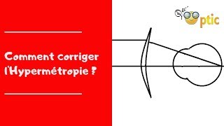 Comment corriger lHypermétropie [upl. by Oicanata]