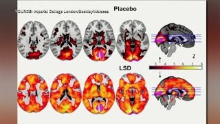 LSD study shows evidence of higher level of consciousness [upl. by Mehetabel]