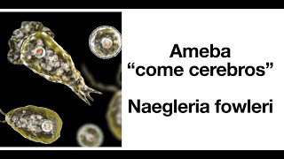 Naegleria fowleri  Ameba come cerebros  Factores de riesgo síntomas tratamiento [upl. by Service33]