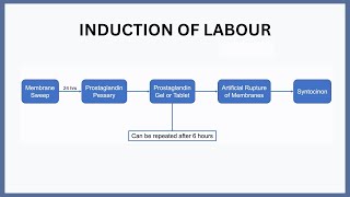 Induction of Labour Explained [upl. by Atnek]