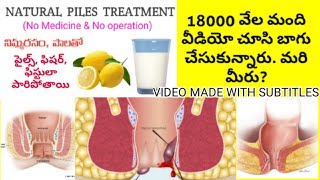 Piles Fissures and Fistula Treatment at Home in Telugu  Telugu Tips [upl. by Belford]