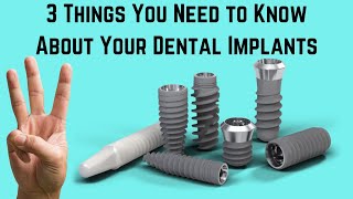 3 things you need to know about your dental implants [upl. by Naresh]