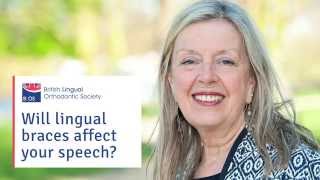 Will lingual braces affect my speech [upl. by Ilera]