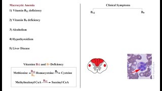 USMLE ACE Video 170 Macrocytic Anemia [upl. by Aihsemat]