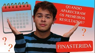 QUANTO TEMPO PARA OS PRIMEIROS RESULTADOS DA FINASTERIDA l MINHA EXPERIÊNCIA [upl. by Atirehgram]