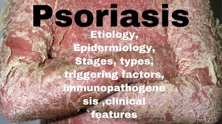 Psoriasis dermatology  epidemiology etiology triggering factors immunopathogenesis typesstages [upl. by Akeret]