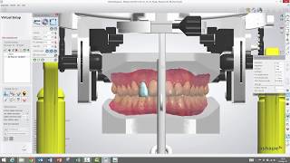 3Shape Ortho Analyzer  How to Use the Virtual Articulator in Ortho Analyzer [upl. by Onek]