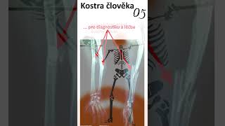 28 Kostra člověka05 anatomie biologie maturita [upl. by Atika12]