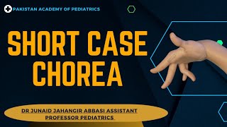 Short Case Chorea  Teaching on Patient [upl. by Liddy621]