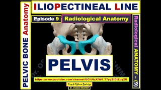 Anatomy 9 Pelvic bone Iliopectineal line Waldenstorm sign Teardrop sign [upl. by Sydel]