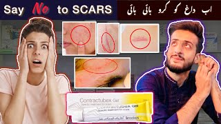 Contractubex Gel  Say “NO” to SCARS  Get rid fo scars Quickly  Merz Pharma Germany 🇩🇪 [upl. by Lleynod]