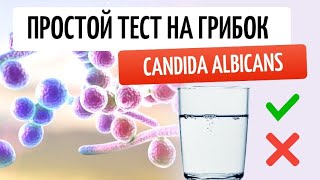 Candida albicans Простой домашний тест на грибок и что делать если тест положительный [upl. by Greta]