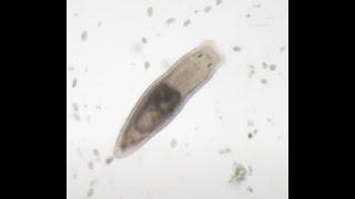 Planarian feeding on Chilomonas and tries a Rotifer Live streamed on Reddit 4272021 [upl. by Arrak]