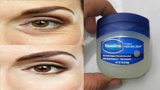 How to remove wrinkles under eyes naturally with Vaseline  Bags under the eyes Reduce wrinkles [upl. by Arakat122]