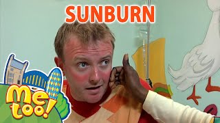 MeTooOfficialTVShow  ☀️🥵 Sunburn 🥵☀️  FullEpisode  SUMMER  TV Show For Kids [upl. by Marya]