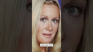 Worst plastic surgery fails foryou celebrities [upl. by Mensch]