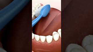 What is the technique of tooth brush dentistry brushing brushingtips oralcare mouthcare [upl. by Gundry486]