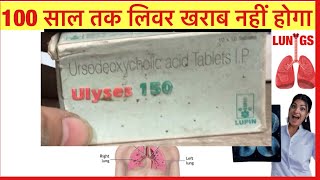 Ulyses 150mg Tablet Full Information In Hindi  Uses  Side effects  Dosage [upl. by Rosinski]