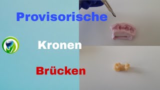 Provisorische Kronen und Brücken mit Patientenfall  Versorgungsabdruck  kein Langzeitprovisorium [upl. by Sedberry519]