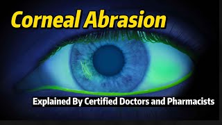 Corneal Abrasion Explained  Medical Topics [upl. by Dillon]