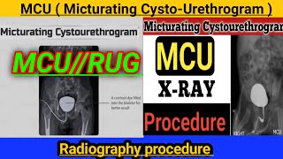 MCU  Micturating CystoUrethrogram   xray RGU and MCU  MCU test in Hindi radiography 2023 [upl. by Sinnelg]