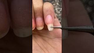 Temporarily Quickly Fixing my quotBroken Nailquot 🥹😭 Ohhh Noo Ouchhhh 😩 nails nailart satisfying [upl. by Anael]