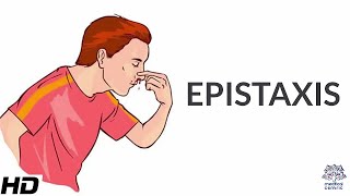 Epistaxis Causes SIgns and Symptoms Diagnosis and Treatment [upl. by Ifok469]