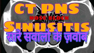 CT Scan PNS Sinusitis in Hindi  by Radiographer Guruji [upl. by Magnusson]