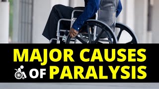 Main Cause of Paralysis  Paralysis Treatment in Hindi [upl. by Anoel]