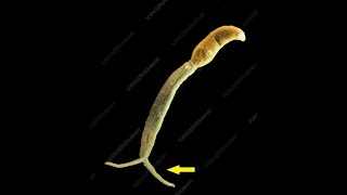 Schistosoma cercaria demonstration Marwa Omar [upl. by Adnawuj]