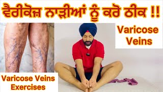 ਵੈਰੀਕੋਜ਼ ਨਾੜੀਆਂ ਨੂੰ ਕਰੋ ਠੀਕ  Varicose Veins Treatment Varicose Veins Relief Exercises at Home 🏡 [upl. by Eimoan]