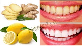 A great recipe for whitening lemon teeth in two minutes make your teeth look like pearls [upl. by Trinia168]