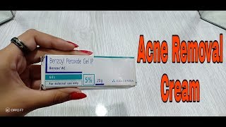 Benzoyl Peroxide 5 Gel Review in Hindi  Acne and Pimples Treatment [upl. by Naerad12]