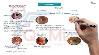 Oftalmología  01 Síndrome ojo rojo [upl. by Anifares]