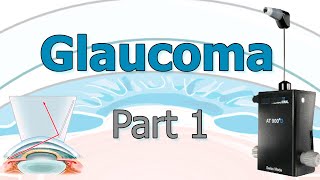 Glaucoma 1 Examen Clínico [upl. by Ydospahr]