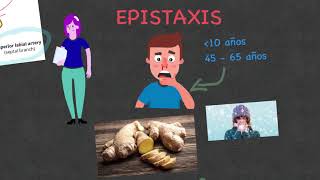 Epistaxis  Sangrado nasal Etiología diagnóstico y tratamiento [upl. by Oznofla]